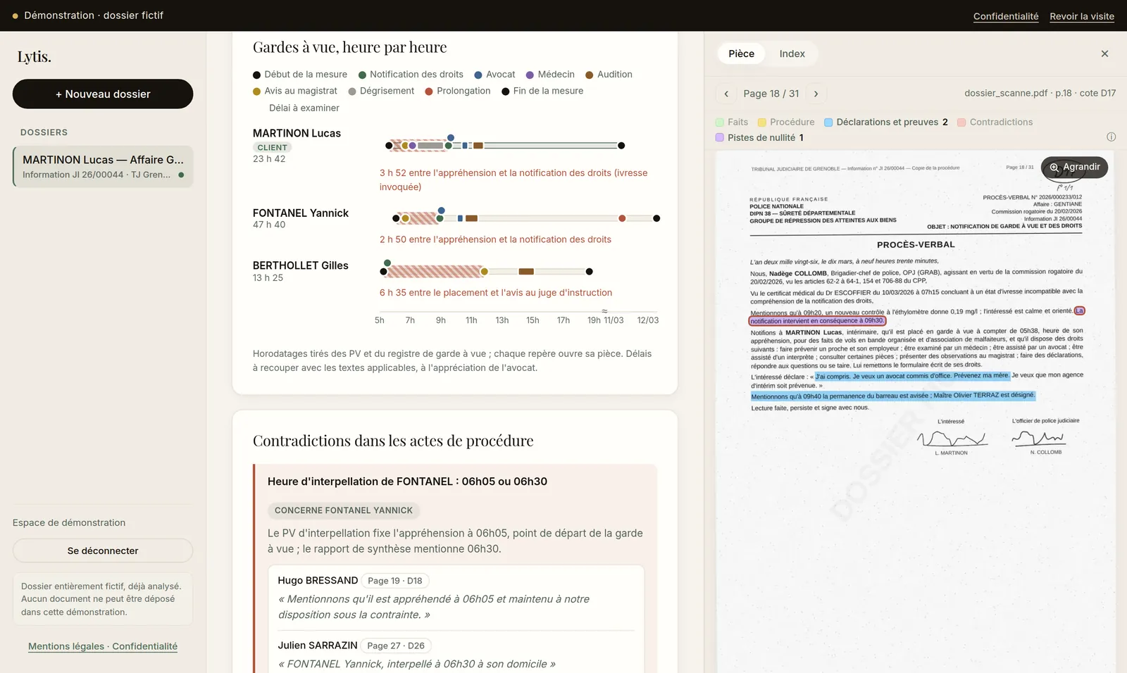Chronogramme des gardes à vue, avec les délais à examiner hachurés.